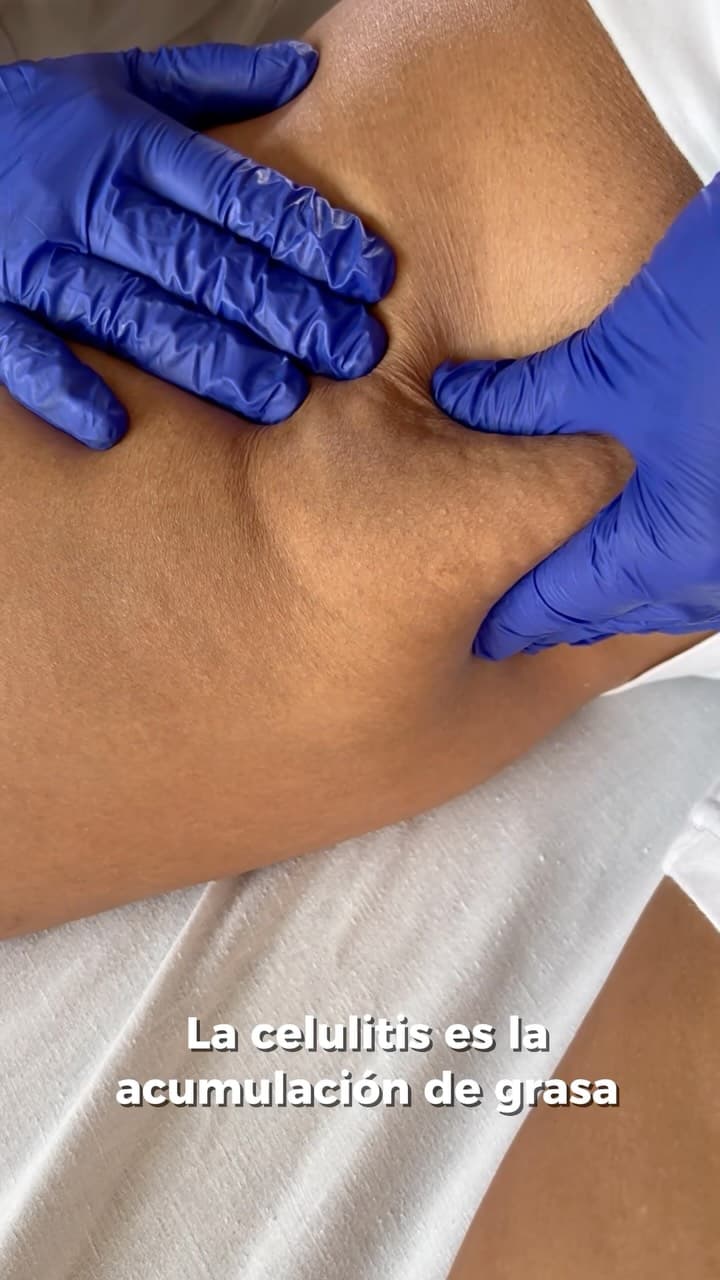 ✨ Mejora la apariencia de la celulitis y luce una piel más firme, uniforme y rev