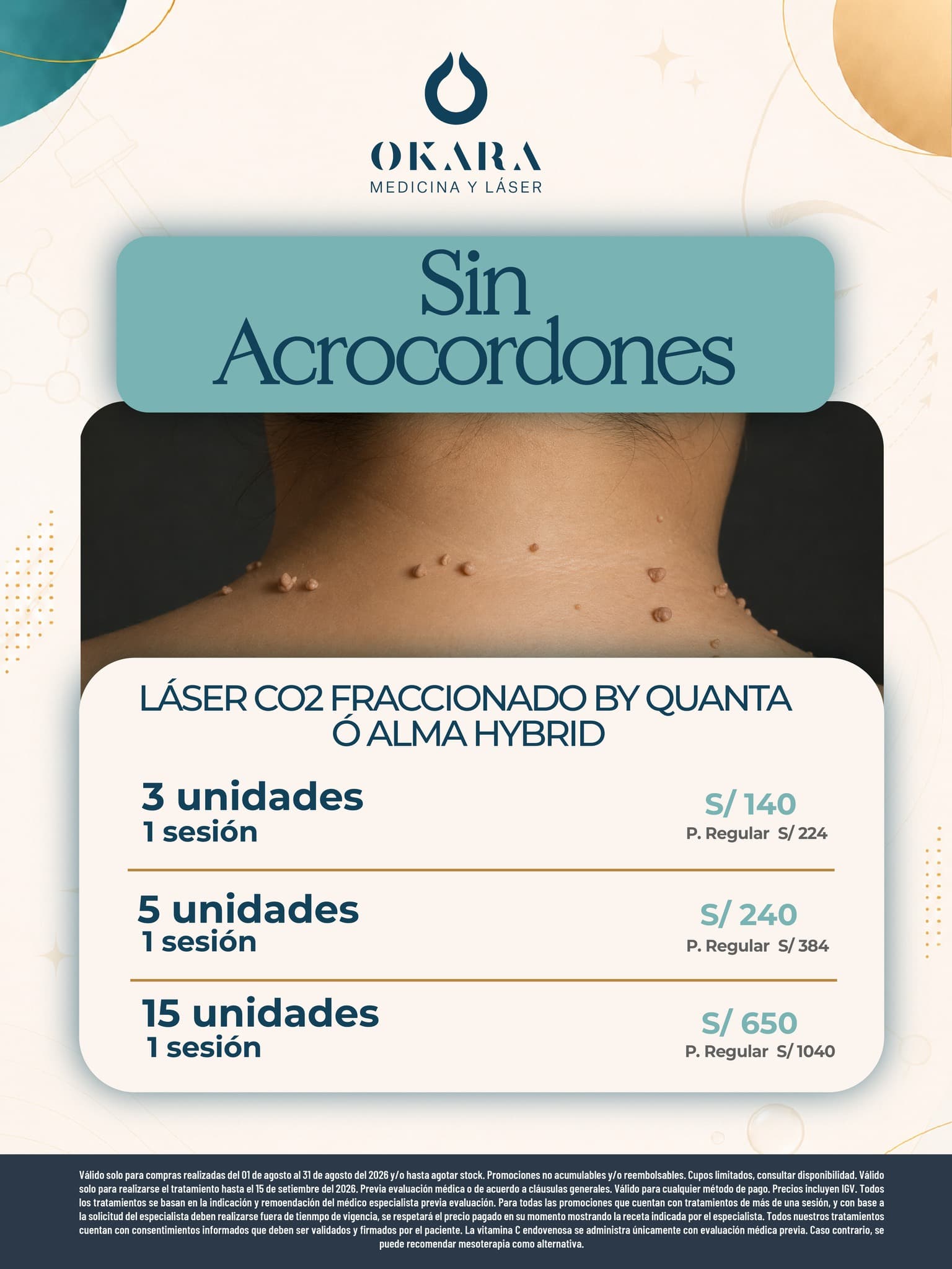 Promoción de Okara — foto 8 de 10