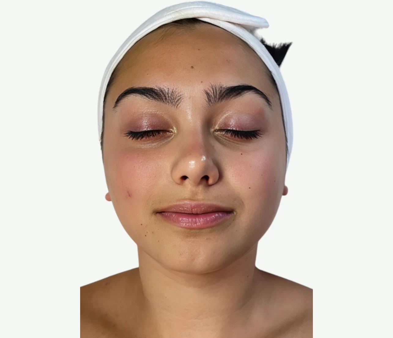 limpieza-dermatologica-A