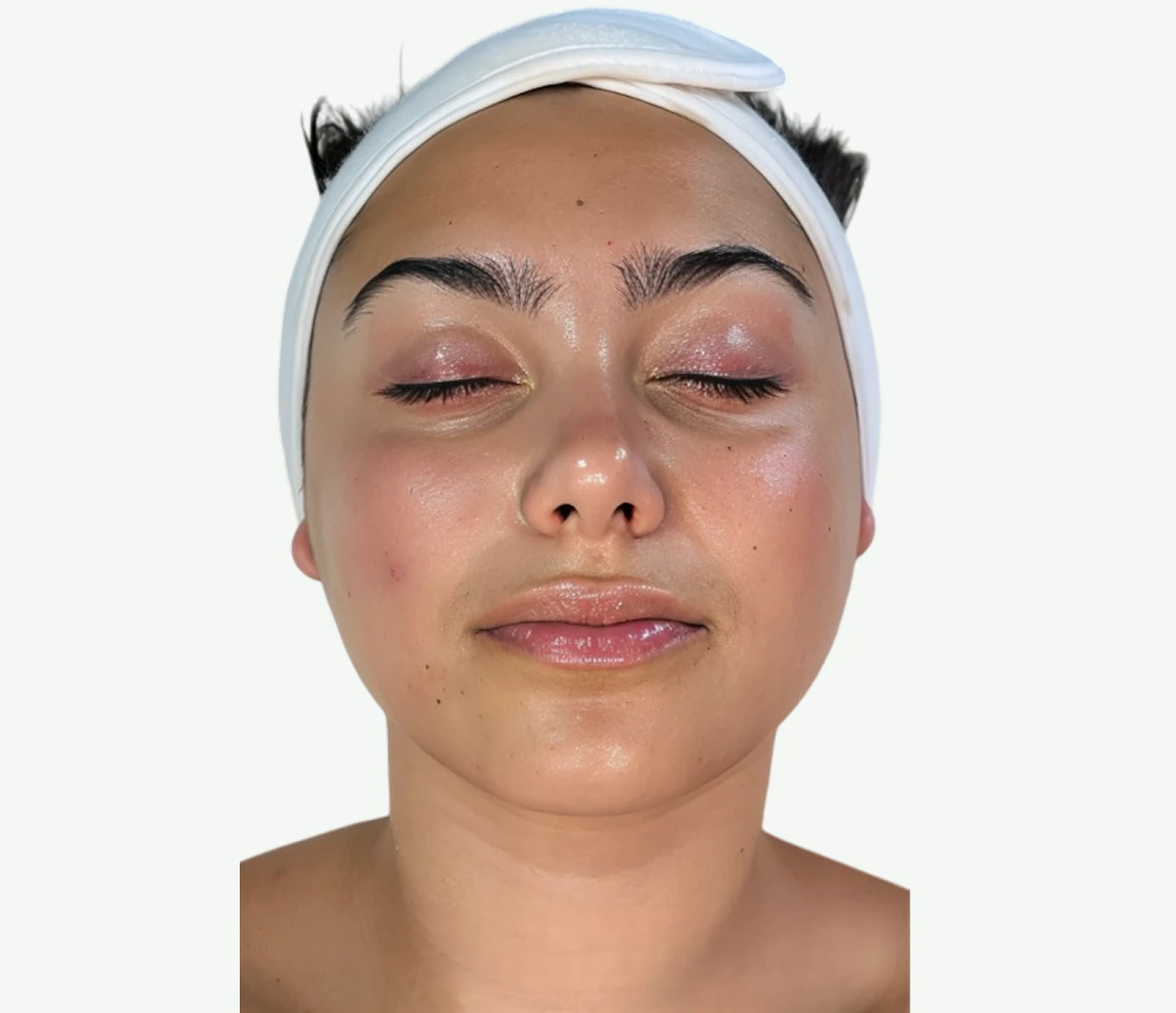 limpieza-dermatologica-D
