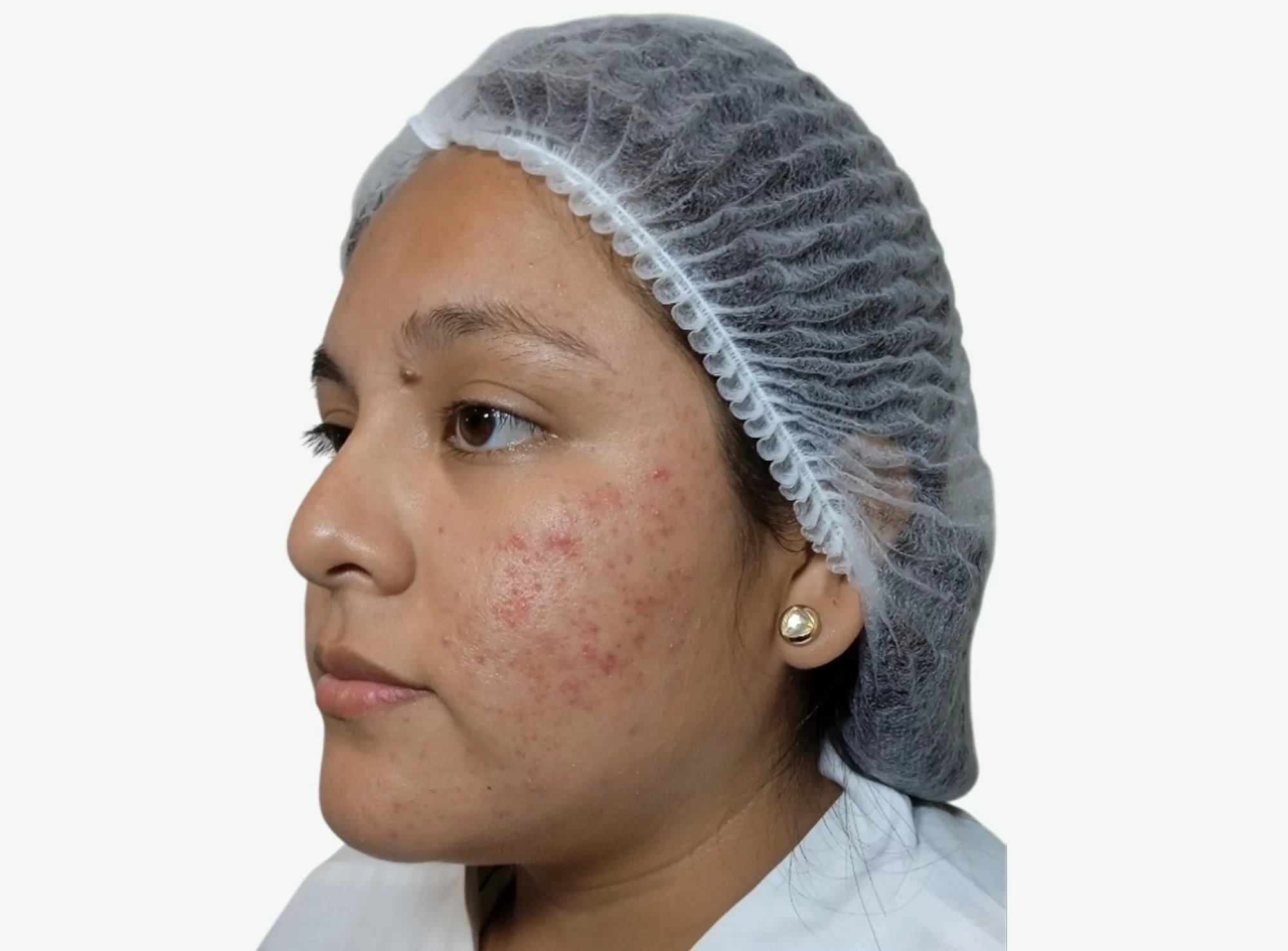 ozonoterapia-D
