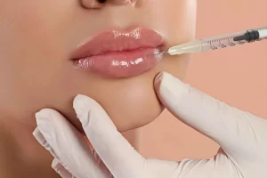 labios